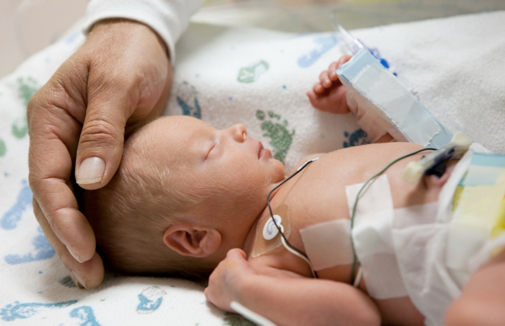 研究评估了涉嫌稀有疾病的新生儿