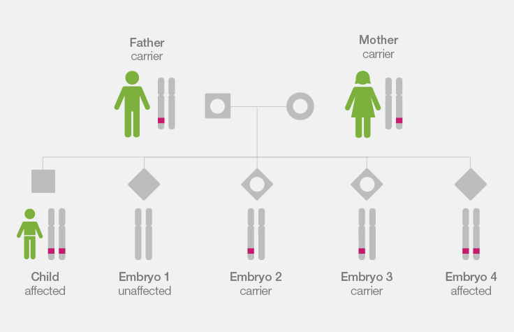 PGD for single gene disorders